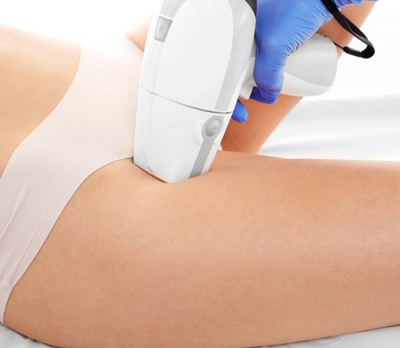 laser-hair-removal-watergardens